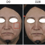 Algosoft Clinical Studies