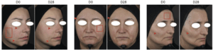 Algosoft Clinical Studies